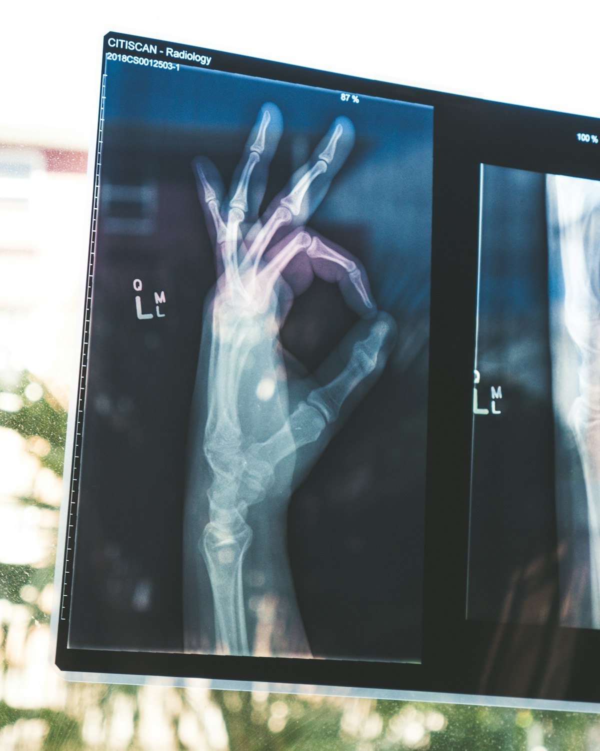 HIPAA-Compliant SEO: Dominating Local Health Search